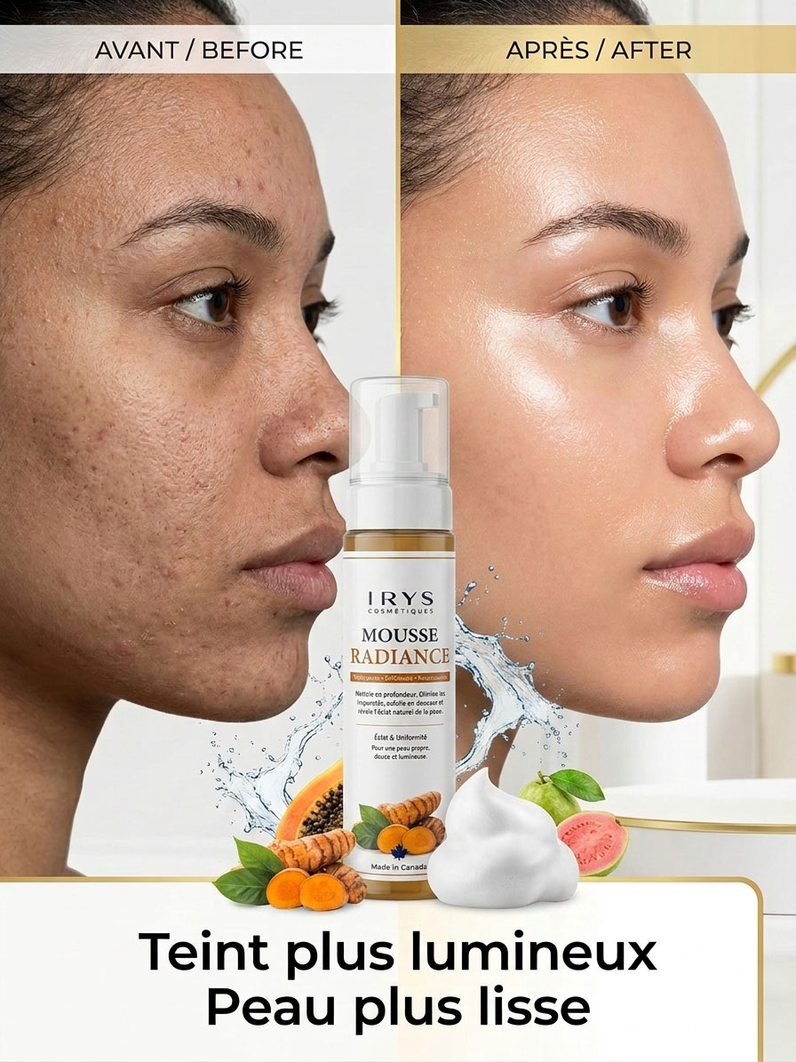 effets mousse radiance avant apres